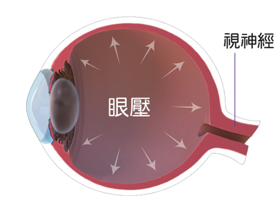 眼壓與視神經視意圖